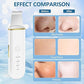 Ultrasonic Facial Cleanser, 4 Modes, Facial Scrub with Spatula, USB Rechargeable, White